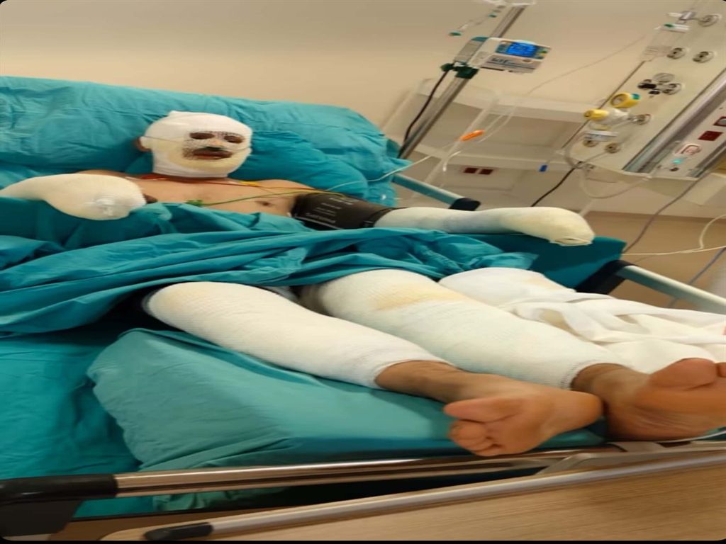 Orman yangınına müdahale sırasında ağır yaralanan eşinin son halini paylaştı