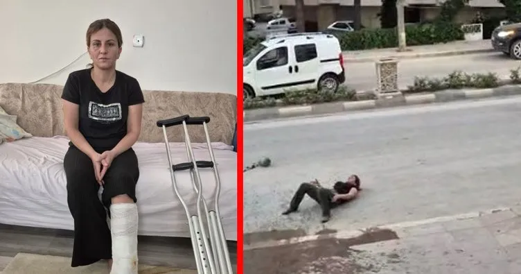 Konya'da öldüresiye dövülen Dudu Gez Çat vahşeti anlattı! Meğer bu ilk değilmiş...