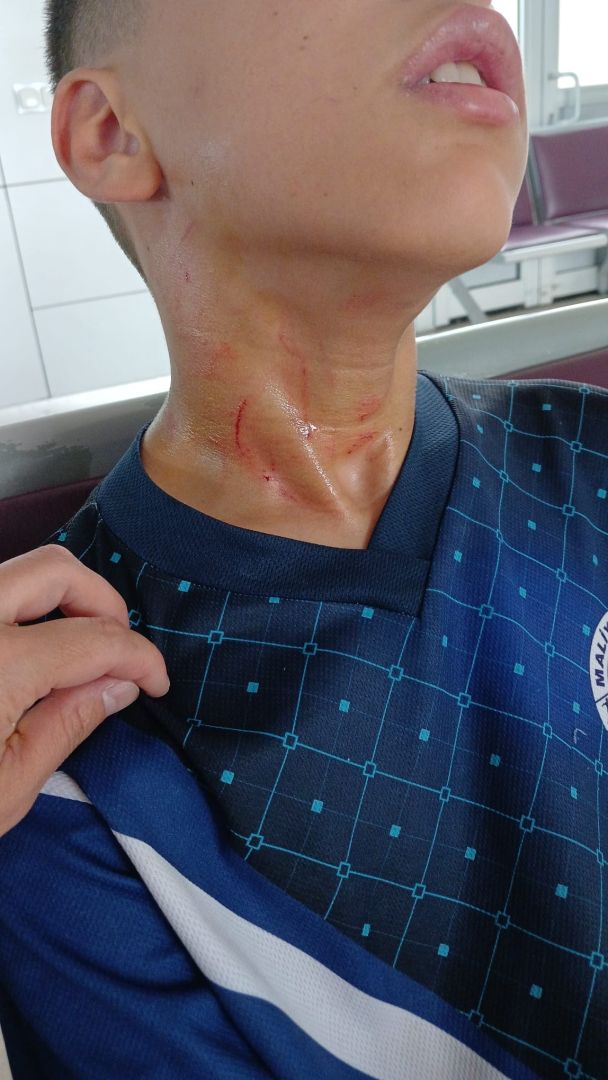 Konya’daki ortaokulda öğretmenden öğrenciye darp iddiası: "Seni öldürürüm" 