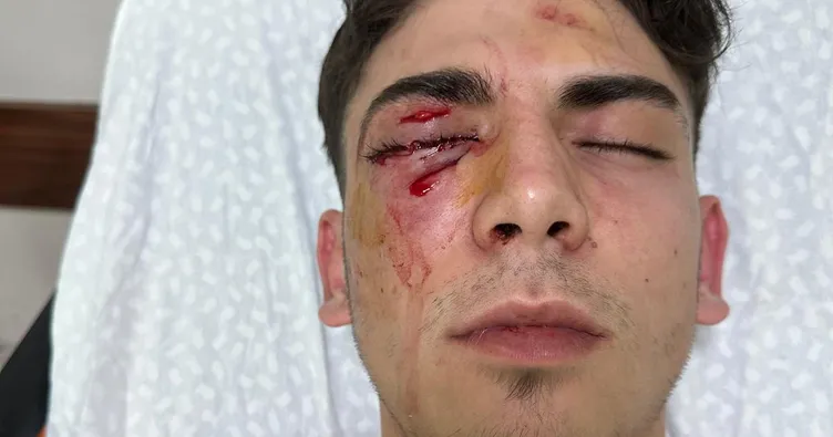 Yer Konya... Ali’yi kör eden zorbalar bu kez ‘öldürmeye teşebbüs’ suçundan tutuklandı