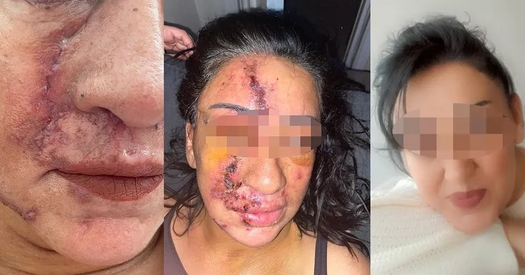 Konya'da  estetik faciası