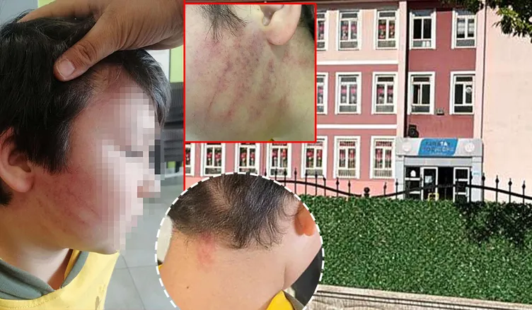 Yer Konya... Okulda şiddetin başrolünde bu kez veli var! 8 yaşındaki çocukları temizlik fırçası ile darp ettiler